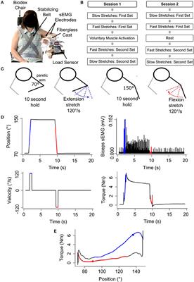 Impact of Voluntary Muscle Activation on Stretch Reflex Excitability in Individuals With Hemiparetic Stroke